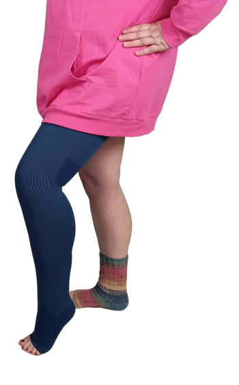 Frau mit Kompressionsstrumpf